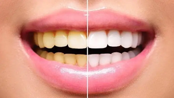 Những dụng cụ không thể thiếu cho phòng ngủ tiện nghi Những dụng cụ không thể thiếu cho phòng ngủ tiện nghi